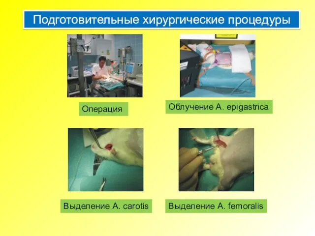 Операция Выделение A. carotis Выделение A. femoralis Облучение A. epigastrica Подготовительные хирургические процедуры