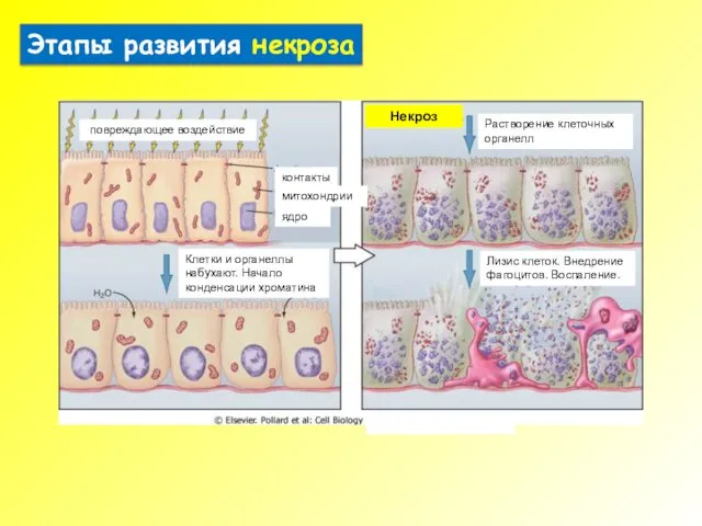 контакты митохондрии ядро повреждающее воздействие Некроз Клетки и органеллы набухают.