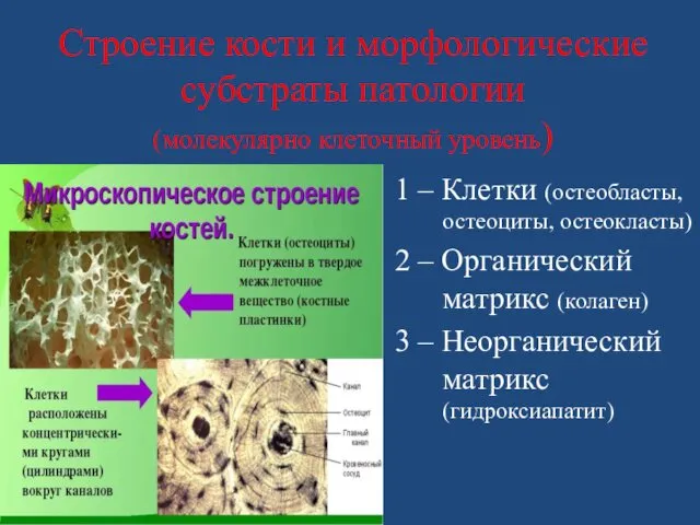 Строение кости и морфологические субстраты патологии (молекулярно клеточный уровень) 1