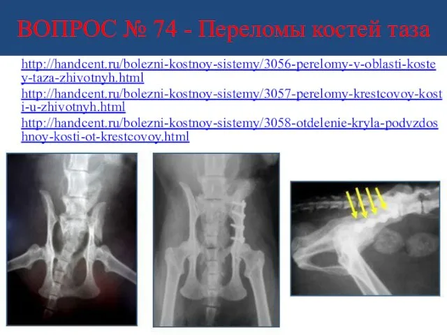 ВОПРОС № 74 - Переломы костей таза http://handcent.ru/bolezni-kostnoy-sistemy/3056-perelomy-v-oblasti-kostey-taza-zhivotnyh.html http://handcent.ru/bolezni-kostnoy-sistemy/3057-perelomy-krestcovoy-kosti-u-zhivotnyh.html http://handcent.ru/bolezni-kostnoy-sistemy/3058-otdelenie-kryla-podvzdoshnoy-kosti-ot-krestcovoy.html