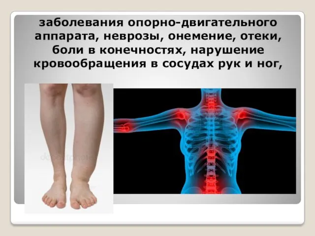 заболевания опорно-двигательного аппарата, неврозы, онемение, отеки, боли в конечностях, нарушение кровообращения в сосудах рук и ног,