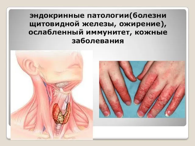 эндокринные патологии(болезни щитовидной железы, ожирение), ослабленный иммунитет, кожные заболевания