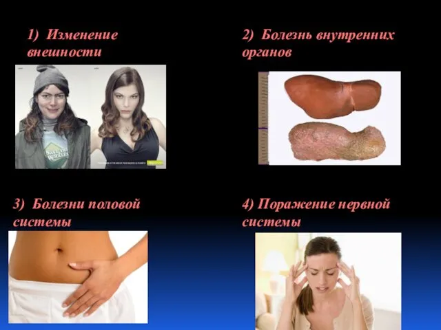 1) Изменение внешности 2) Болезнь внутренних органов 3) Болезни половой системы 4) Поражение нервной системы