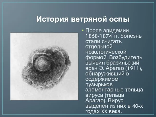 История ветряной оспы После эпидемии 1868-1874 гг. болезнь стали считать