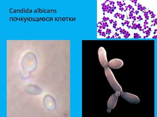 Candida albicans почкующиеся клетки