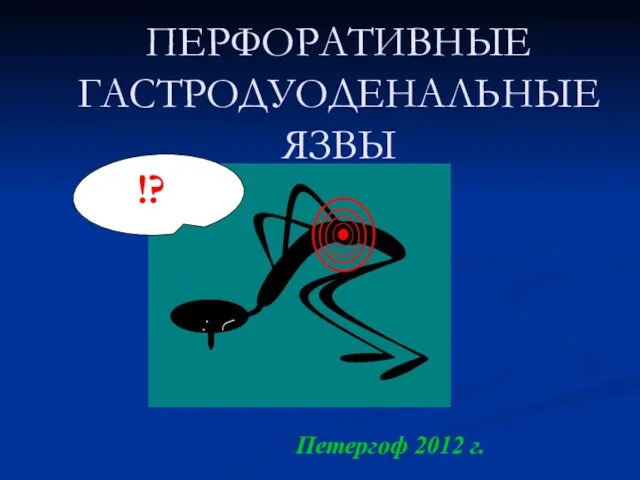 ПЕРФОРАТИВНЫЕ ГАСТРОДУОДЕНАЛЬНЫЕ ЯЗВЫ Петергоф 2012 г. !?