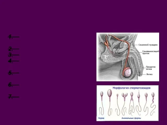 Путь сперматозоида Извитой семенной каналец (350-400) – 1 м Прямой