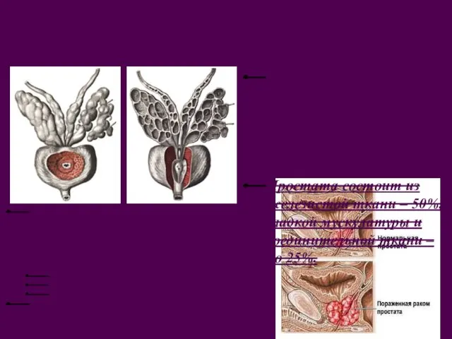 Простата Железистая ткань представлена в виде простатических железок (50), вырабатывающих