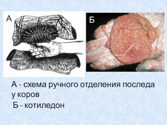 А - схема ручного отделения последа у коров Б - котиледон А Б