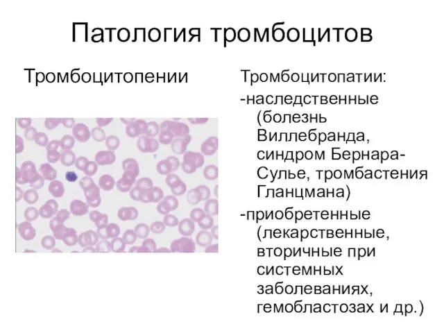 Патология тромбоцитов Тромбоцитопении Тромбоцитопатии: -наследственные (болезнь Виллебранда, синдром Бернара- Сулье,