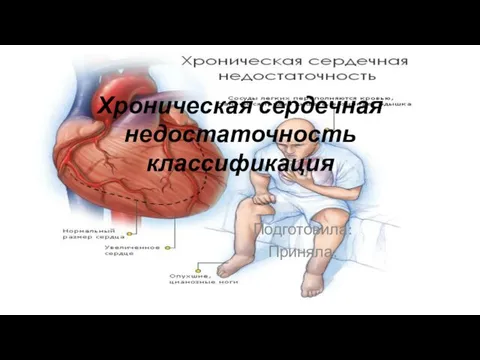 Хроническая сердечная недостаточность классификация Подготовила: Приняла: