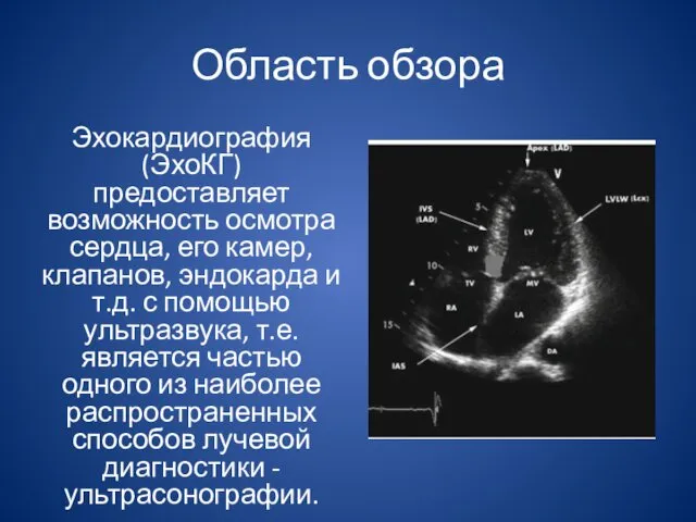 Область обзора Эхокардиография (ЭхоКГ) предоставляет возможность осмотра сердца, его камер,