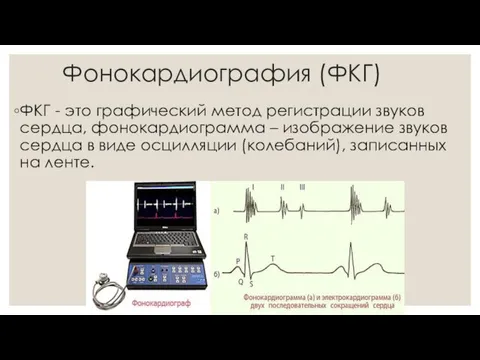 Фонокардиография (ФКГ) ФКГ - это графический метод регистрации звуков сердца,