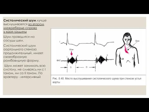 Систолический шум лучше выслушивается во втором межреберье справа у края