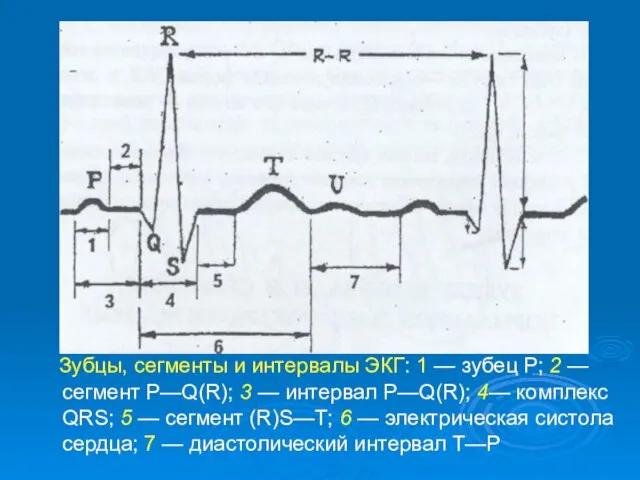 Зубцы, сегменты и интервалы ЭКГ: 1 — зубец Р; 2