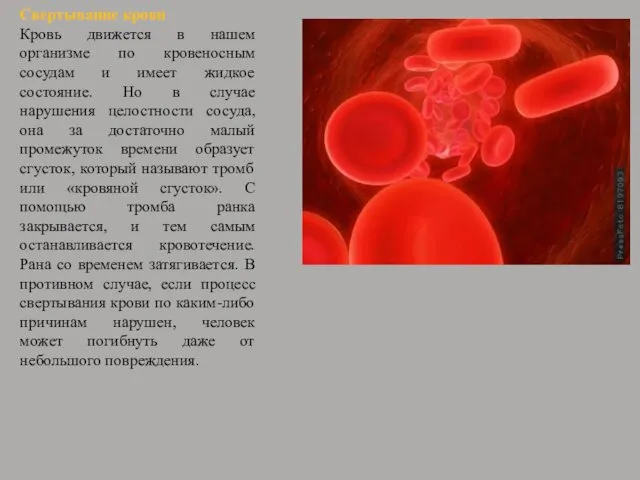 Свертывание крови Кровь движется в нашем организме по кровеносным сосудам и имеет жидкое