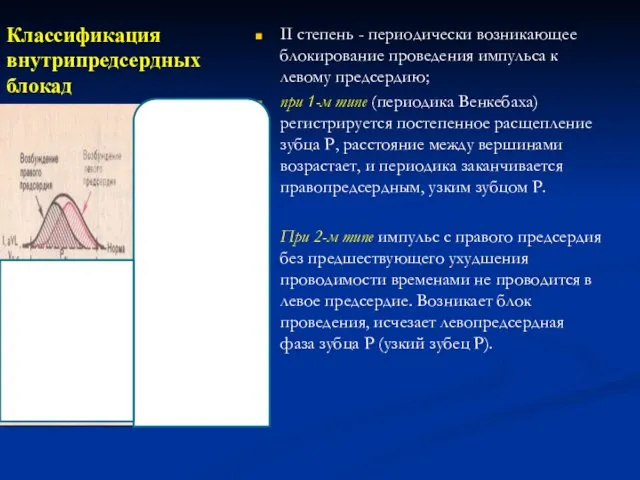 Классификация внутрипредсердных блокад II степень - периодически возникающее блокирование проведения импульса к левому