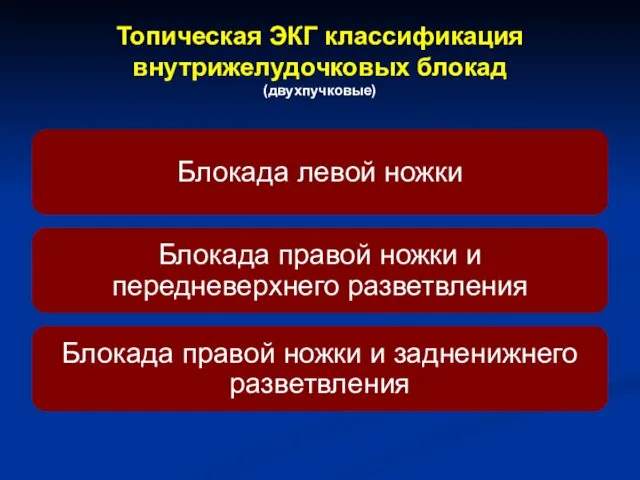 Топическая ЭКГ классификация внутрижелудочковых блокад (двухпучковые)