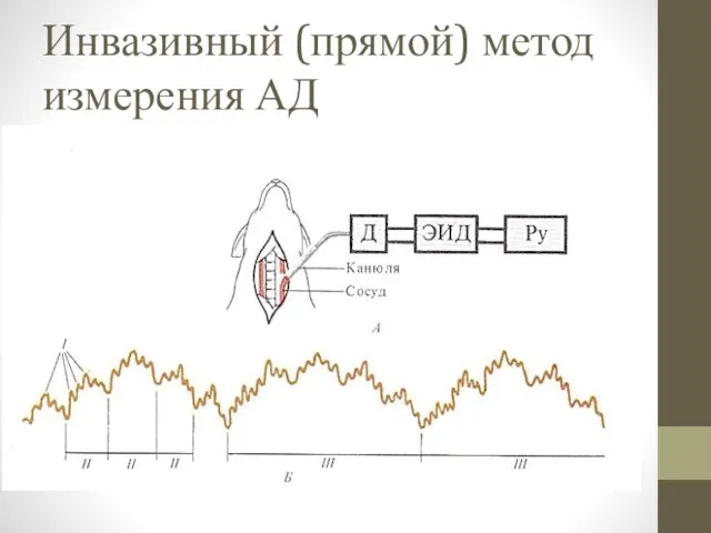 Инвазивный (прямой) метод измерения АД