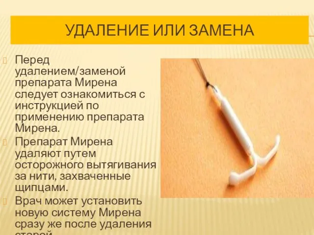 УДАЛЕНИЕ ИЛИ ЗАМЕНА Перед удалением/заменой препарата Мирена следует ознакомиться с