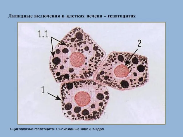 Липидные включения в клетках печени - гепатоцитах 1-цитоплазма гепатоцита: 1.1-липидные капли; 2-ядро