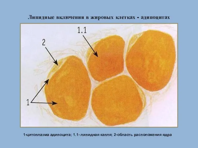 Липидные включения в жировых клетках - адипоцитах 1-цитоплазма адипоцита; 1.1- липидная капля; 2-область расположения ядра
