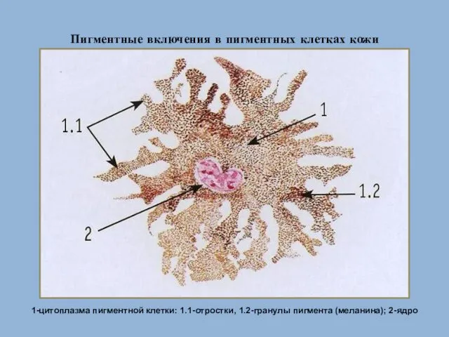 Пигментные включения в пигментных клетках кожи 1-цитоплазма пигментной клетки: 1.1-отростки, 1.2-гранулы пигмента (меланина); 2-ядро