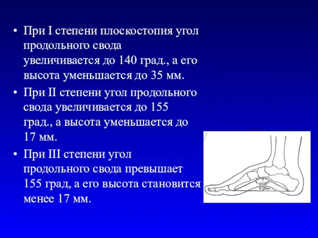 При I степени плоскостопия угол продольного свода увеличивается до 140