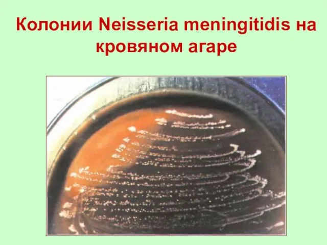 Колонии Neisseria meningitidis на кровяном агаре