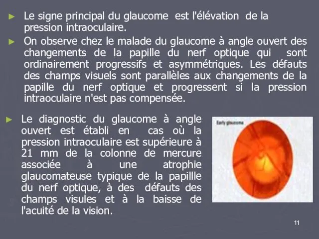 Le diagnostic du glaucome à angle ouvert est établi en
