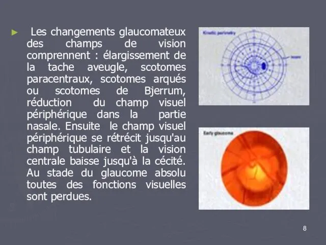 Les changements glaucomateux des champs de vision comprennent : élargissement