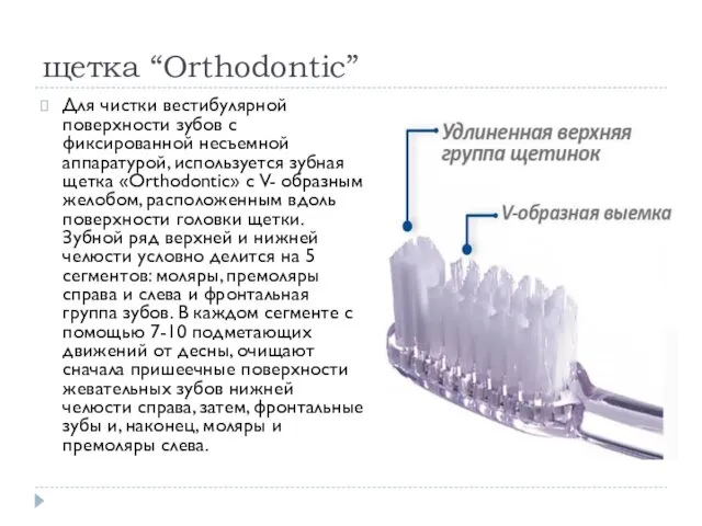 щетка “Orthodontic” Для чистки вестибулярной поверхности зубов с фиксированной несъемной