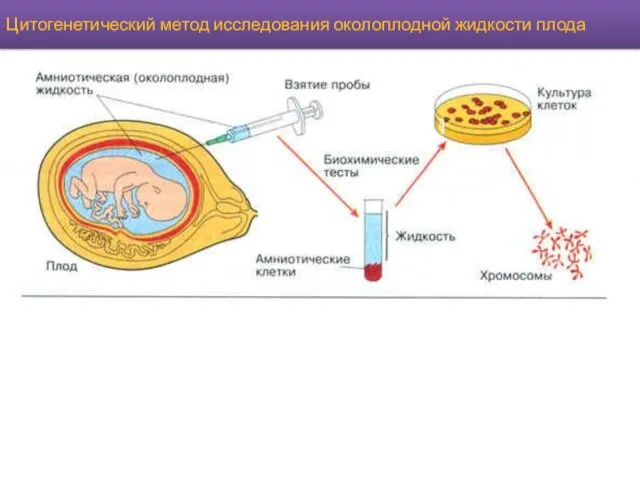 Цитогенетический метод исследования околоплодной жидкости плода