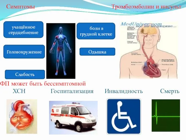 Симптомы Тромбоэмболии и инсульт ФП может быть бессимптомной ХСН Госпитализация