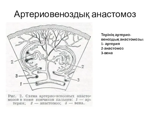 Артериовеноздық анастомоз Терінің артерио-веноздық анастомозы: 1- артерия 2-анастомоз 3-вена