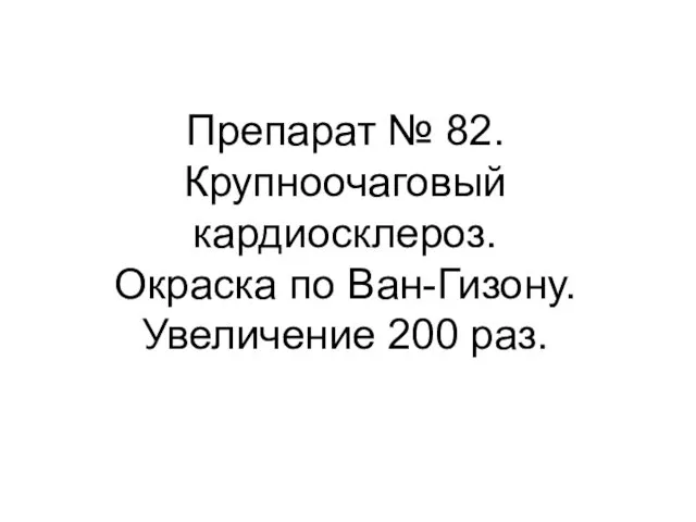 Препарат № 82. Крупноочаговый кардиосклероз. Окраска по Ван-Гизону. Увеличение 200 раз.