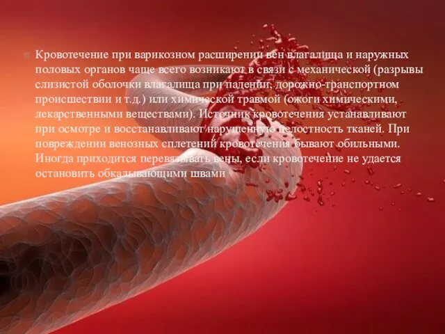 Кровотечение при варикозном расширении вен влагалища и наружных половых органов