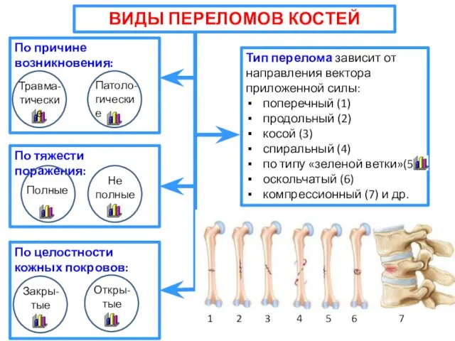 ВИДЫ ПЕРЕЛОМОВ КОСТЕЙ По причине возникновения: По тяжести поражения: Тип