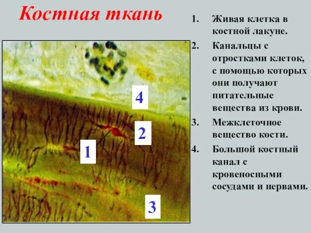 Костная ткань Живая клетка в костной лакуне. Канальцы с отростками