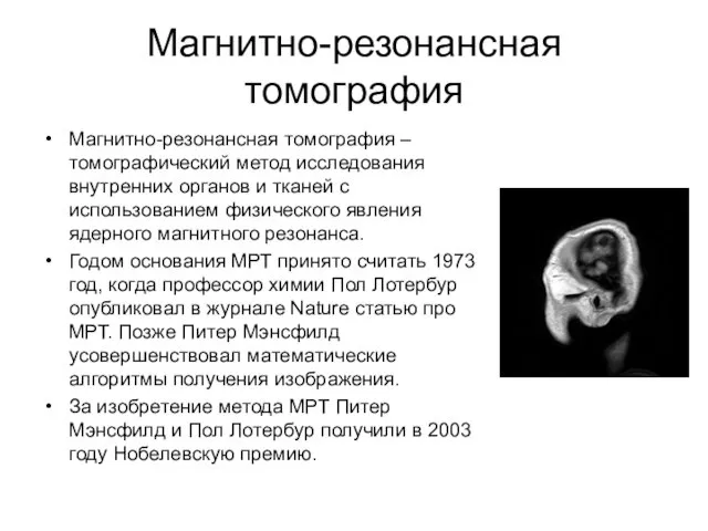 Магнитно-резонансная томография Магнитно-резонансная томография – томографический метод исследования внутренних органов и тканей с