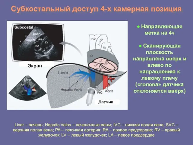 Субкостальный доступ 4-х камерная позиция Датчик Liver – печень; Hepatic