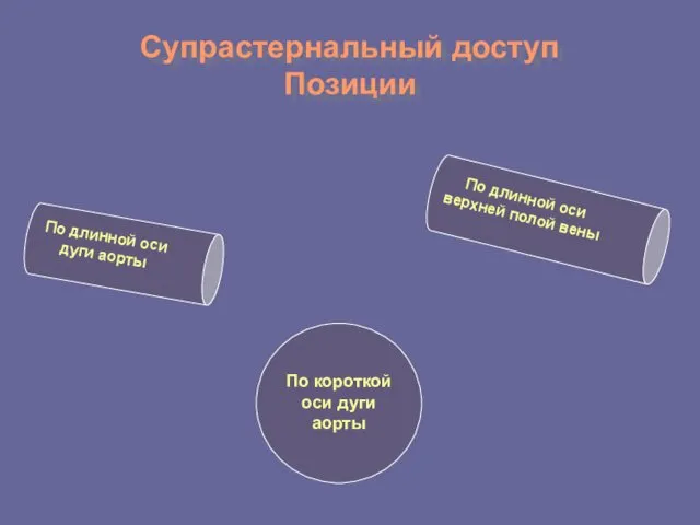 Супрастернальный доступ Позиции По длинной оси дуги аорты По короткой