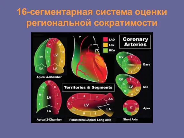 16-сегментарная система оценки региональной сократимости