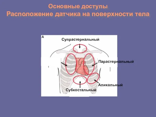 Основные доступы Расположение датчика на поверхности тела Супрастернальный Субкостальный Апикальный Парастернальный