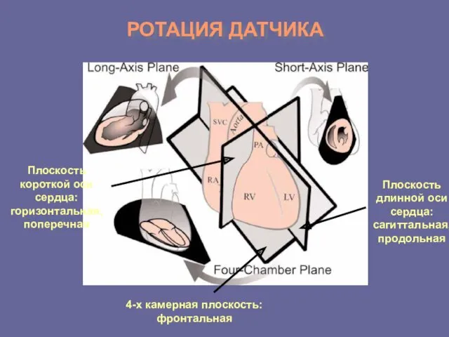 РОТАЦИЯ ДАТЧИКА 4-х камерная плоскость: фронтальная Плоскость короткой оси сердца: