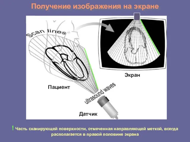 Получение изображения на экране Пациент Датчик Дисплей Дисплей ! Часть