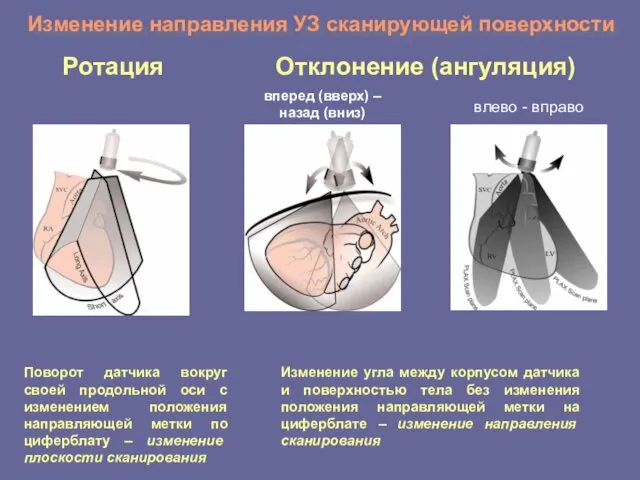 Изменение направления УЗ сканирующей поверхности Ротация Отклонение (ангуляция) Поворот датчика