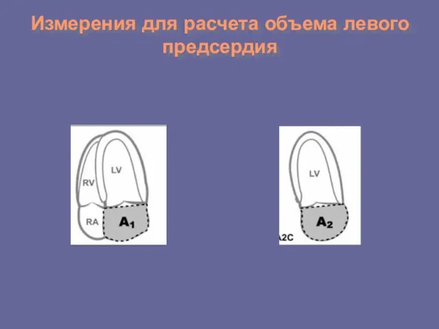 Измерения для расчета объема левого предсердия