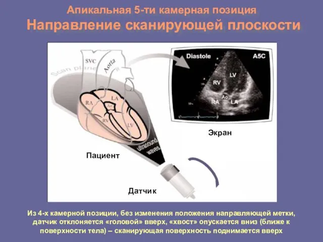 Апикальная 5-ти камерная позиция Направление сканирующей плоскости Из 4-х камерной