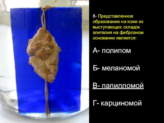 8- Представленное образование на коже из выступающих складок эпителия на